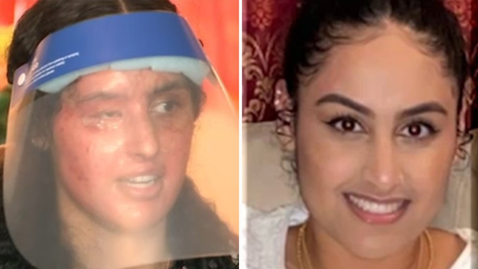 21-year-old recovering from horrifying hazardous substance attack by stranger on Long Island - 21-year-old recovering from horrifying hazardous substance attack by stranger on Long Island