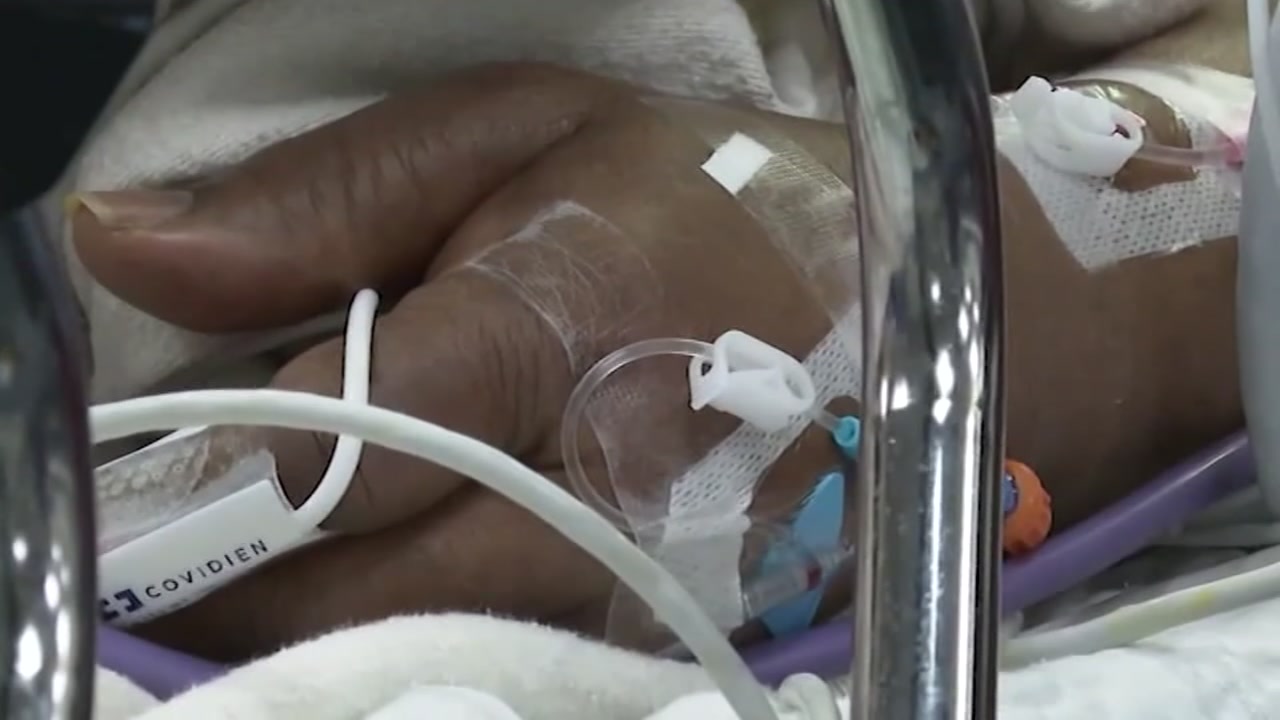 Santa Clara Co. hits 100,000+ COVID-19 cases