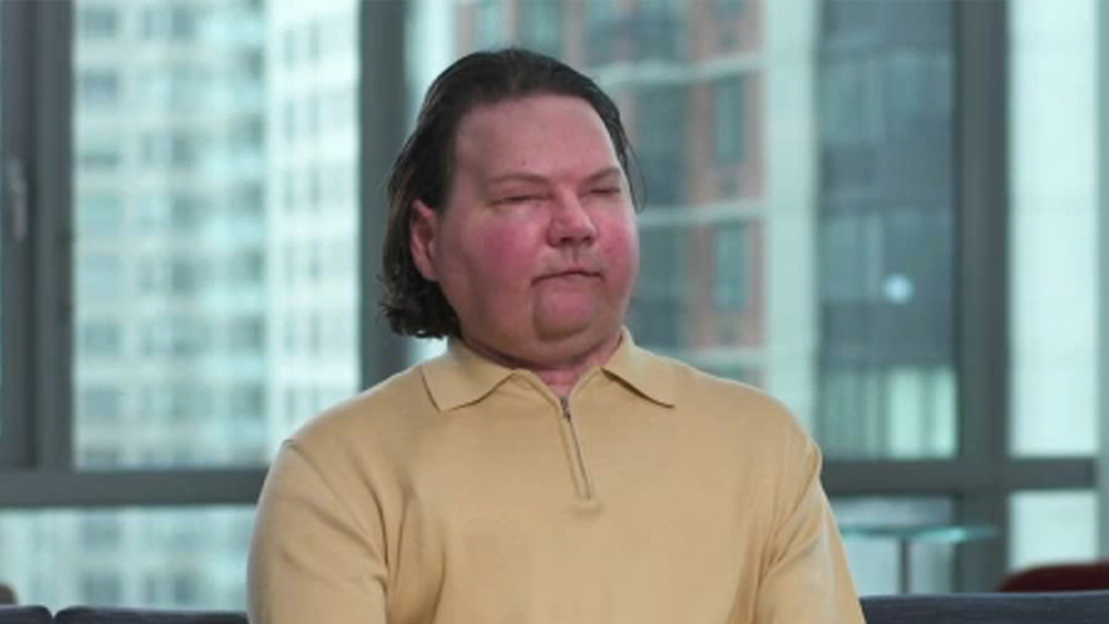 NJ man has successful face, double hand transplants at NYU