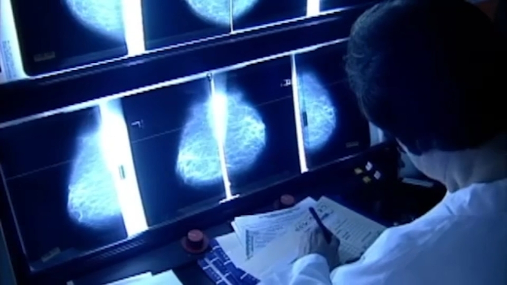 COVID-19 vaccine could cause mammogram result confusion, doctors say