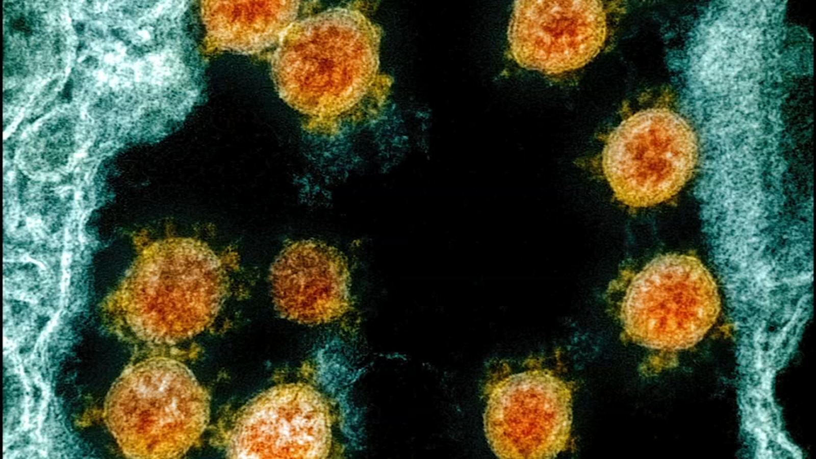 COVID long-term effects: $1.15B NIH plan launched to solve COVID 'long-hauler mystery - Vimarsana News