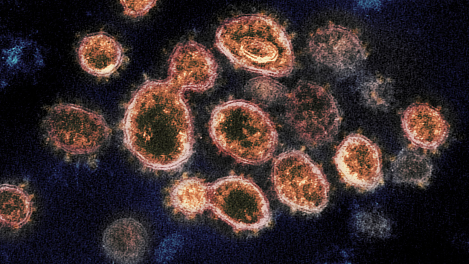 People with antibodies after COVID19 may have shortterm virus