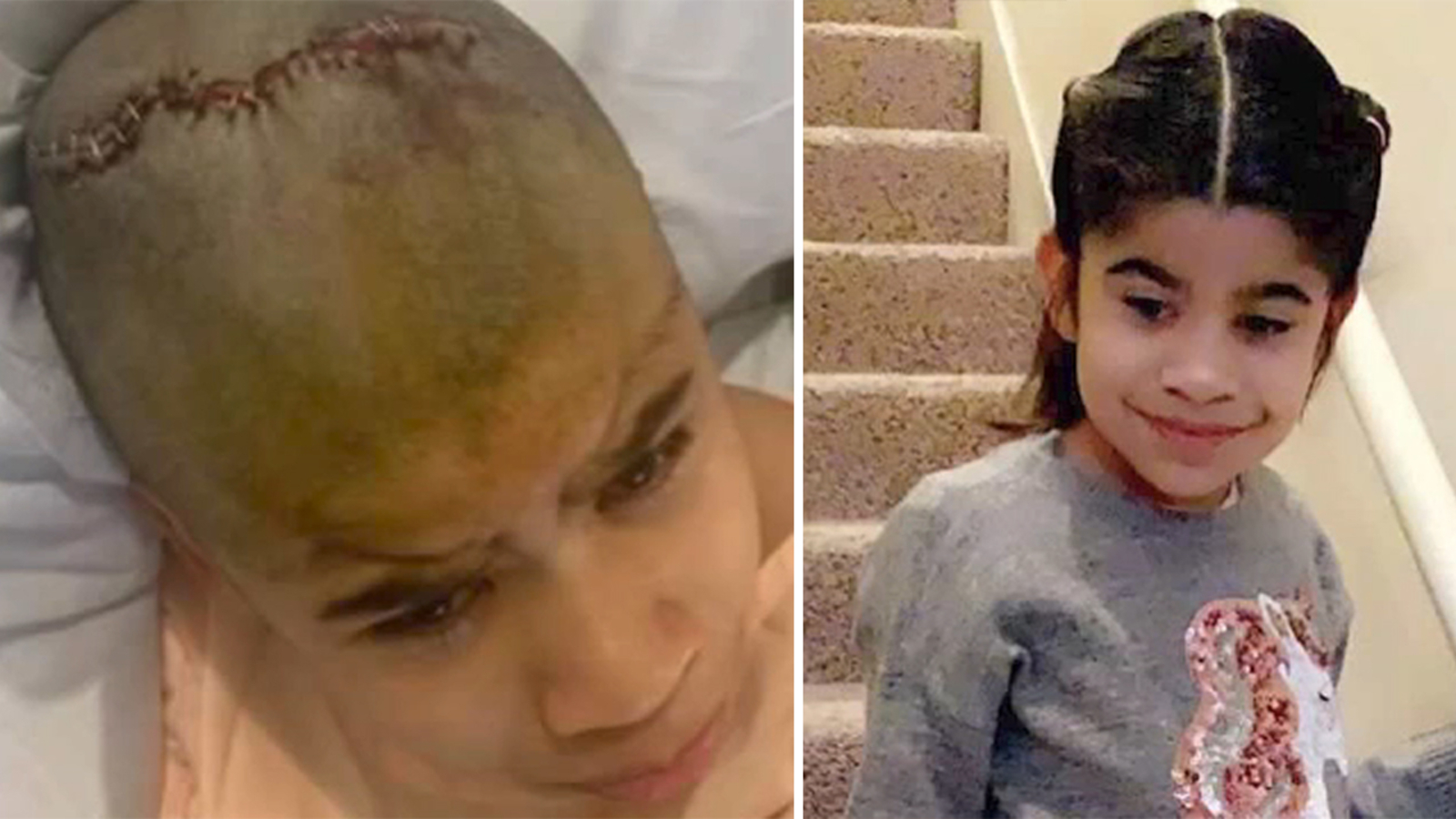 Joellie Mejia, girl with special needs who was shot in head during road rage shooting near Katy