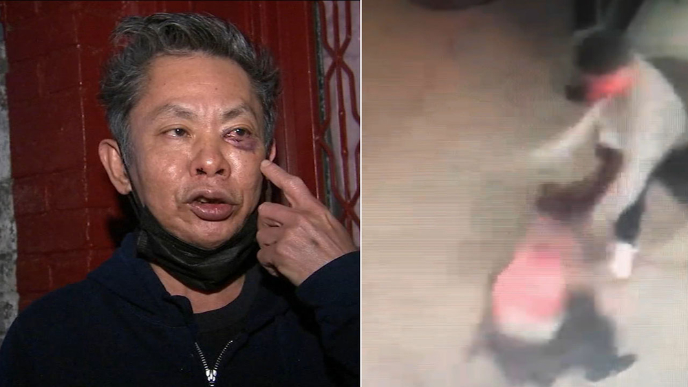 Man describes harrowing, unprovoked attack at subway station