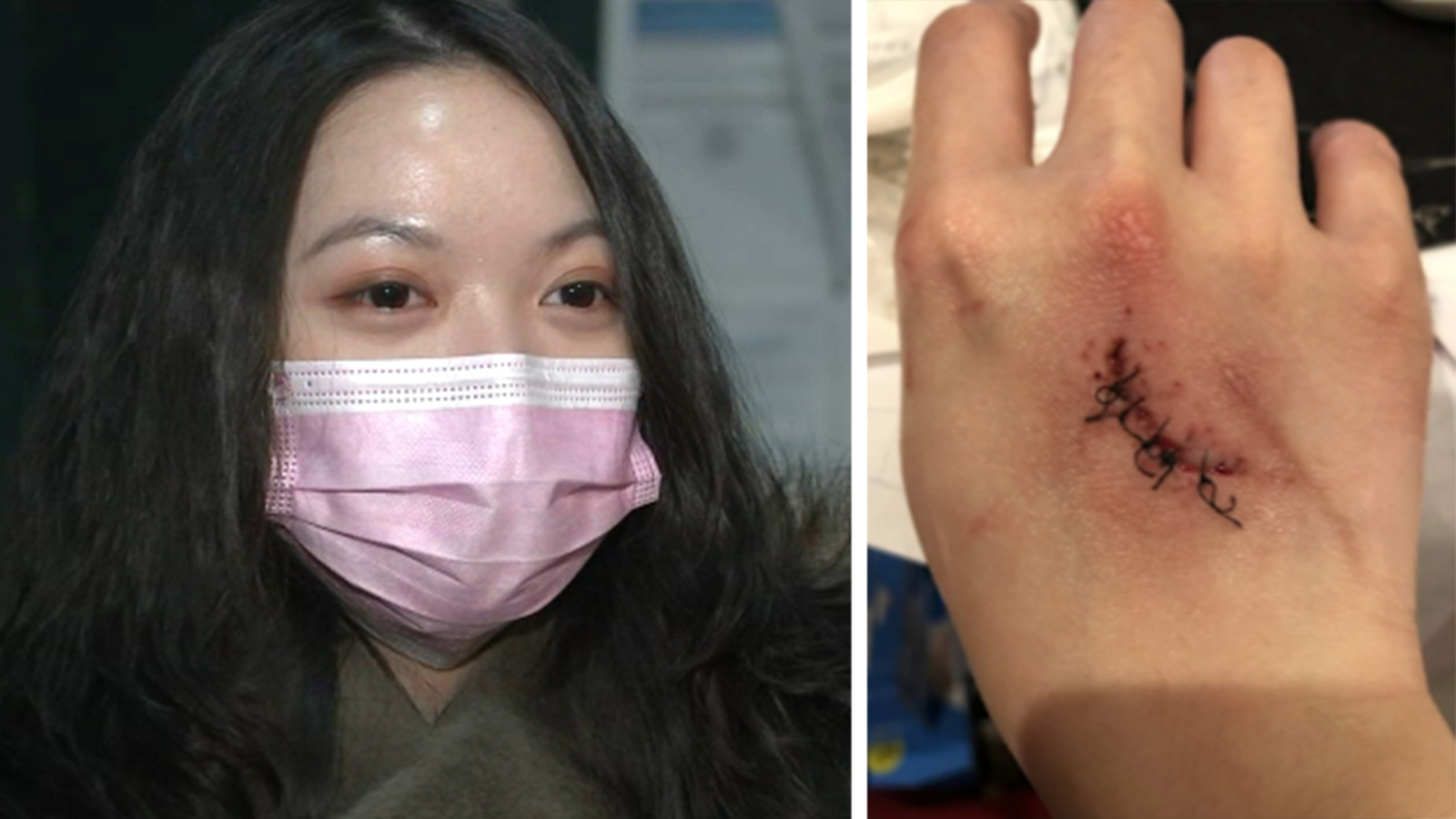 College student slashed across while walking home in Bedford Stuyvesant - Vimarsana News