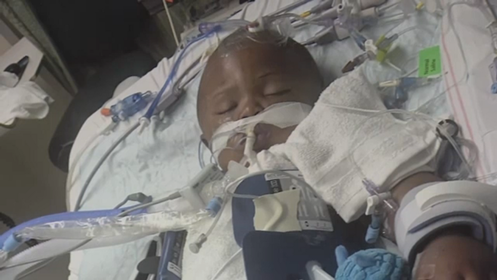 Part of baby's skull removed after officer accidentally shot child
