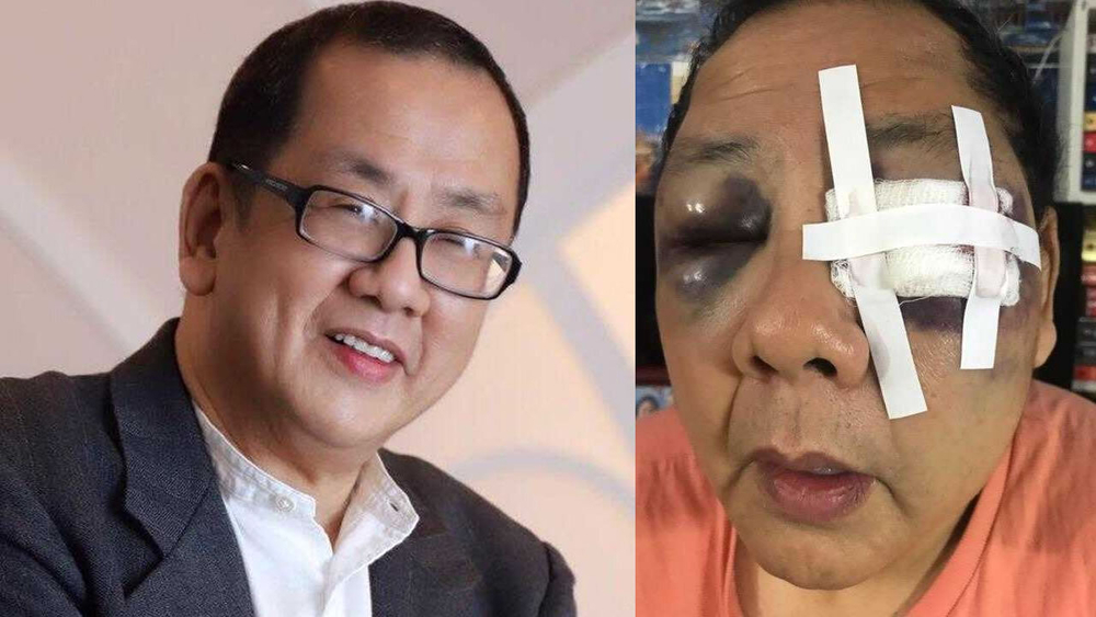 'SF is deteriorating': Asian American man considers move after attack