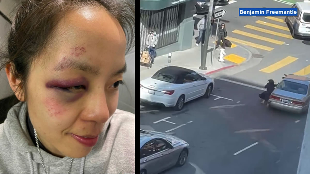 Woman beaten, dragged during brazen SF robbery after church