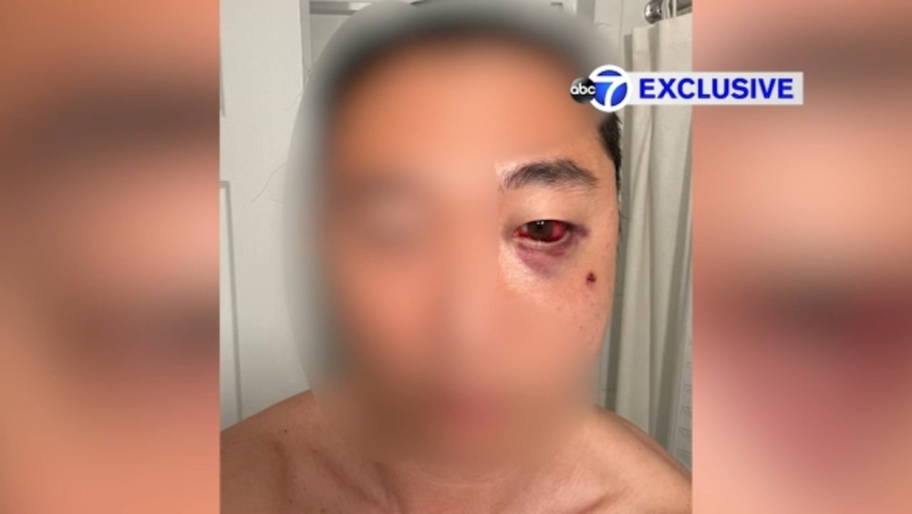 Man with wife and son attacked in Central Park