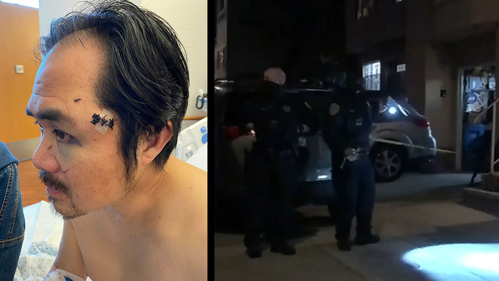 EXCLUSIVE: Asian man recalls stabbing attack in SF's Bayview