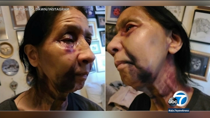 Arrest made after 70yearold woman badly beaten