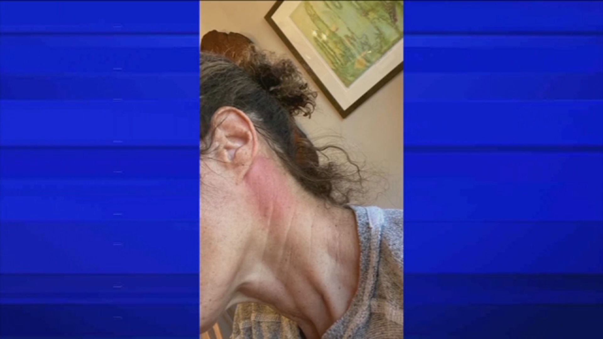 Kemberly Richardson details allergic reaction to COVID-19 vaccine