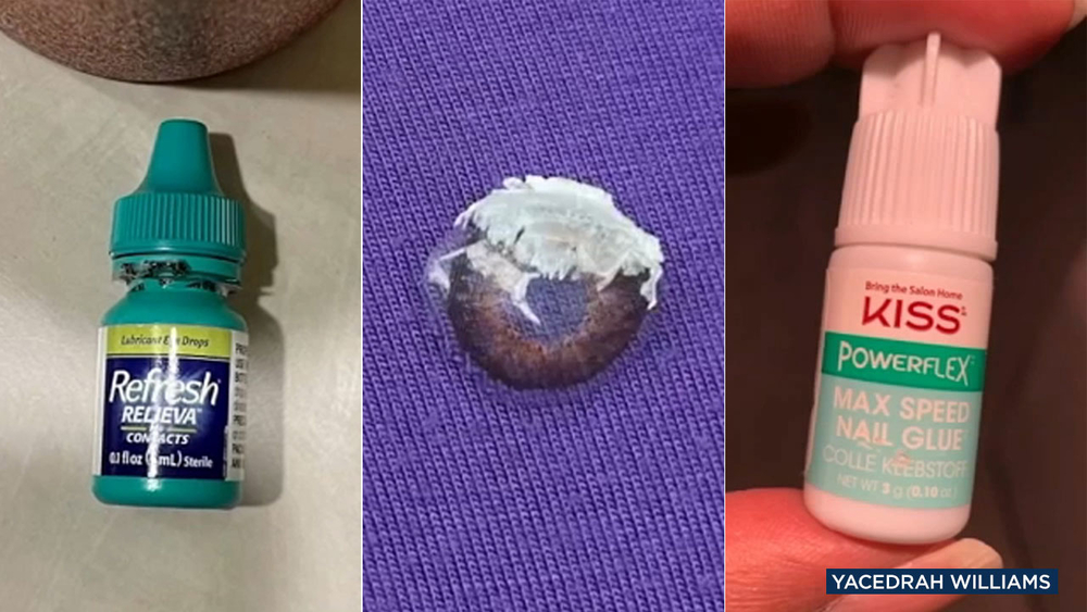 Woman glues eye shut after using what she thought were eye drops
