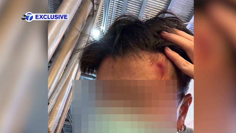Asian American recent FIT grad hit with hammer in Hell's Kitchen