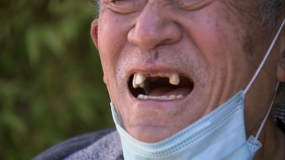 EXCLUSIVE: 71-year-old warns others after brutal Oakland attack