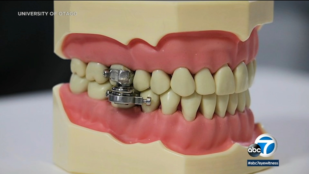 Can you lose weight by locking your teeth shut?