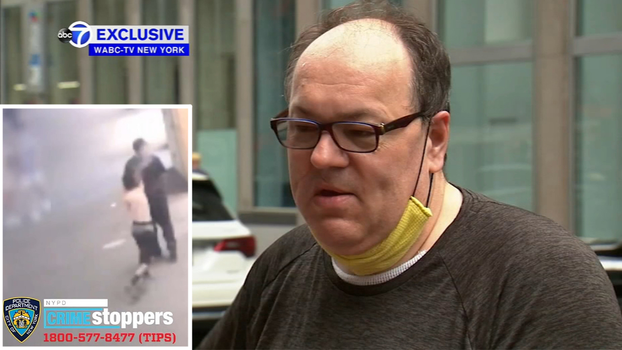 Man suffers burns in random liquid attack on NYC sidewalk