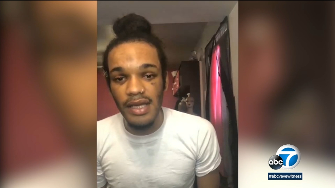 Man beaten outside NoHo hookah lounge says attack was a hate crime