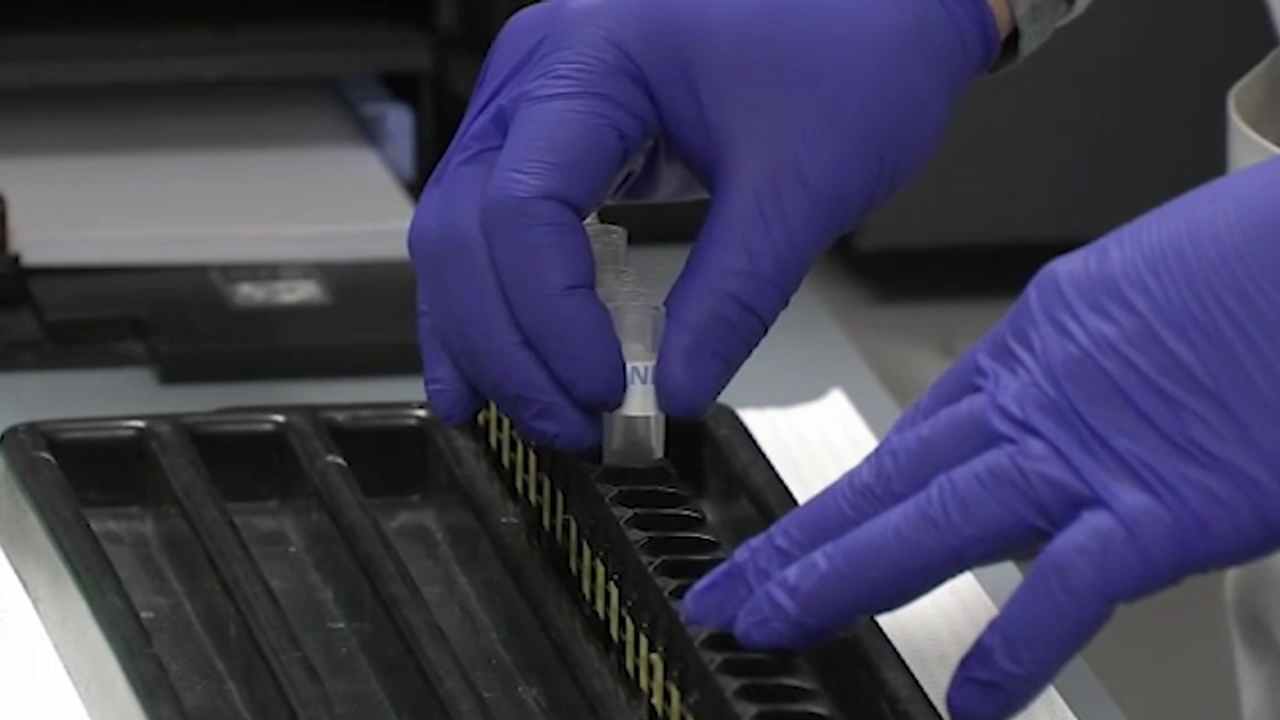EXPLAINER: What is monoclonal antibody infusion?