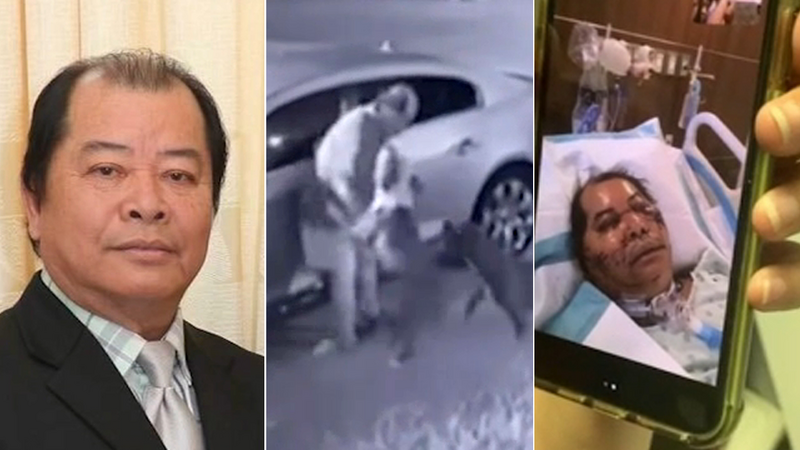 Houston Dog Attack Family Of Victim Ha Mui Thanks Neighbors For Saving His Life Abc13 Houston