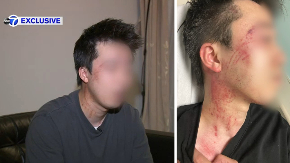 Asian man feared for life during road rage attack on NYC highway