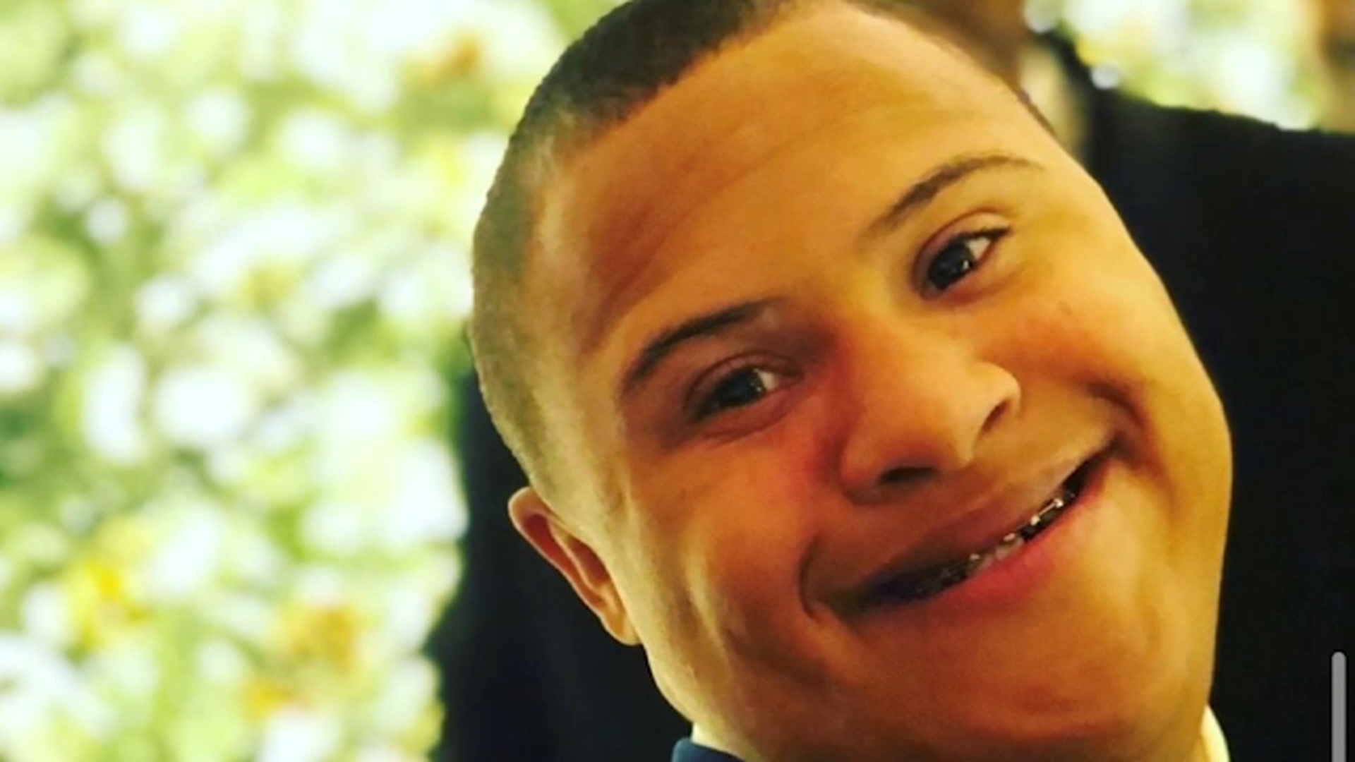 Special needs student running for homecoming king in Lancaster