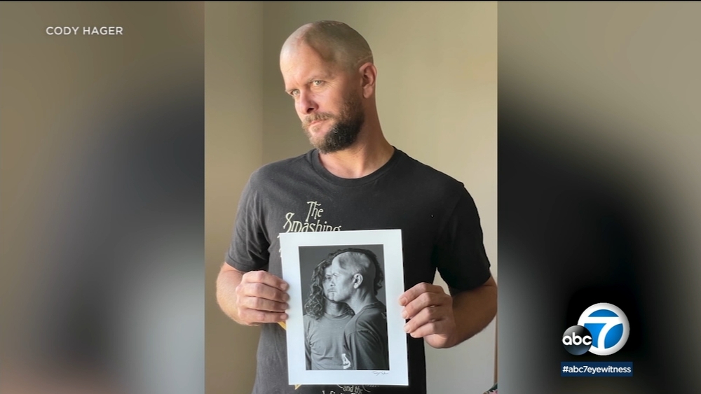 Brain injury survivor becomes 1st to receive transparent skull implant