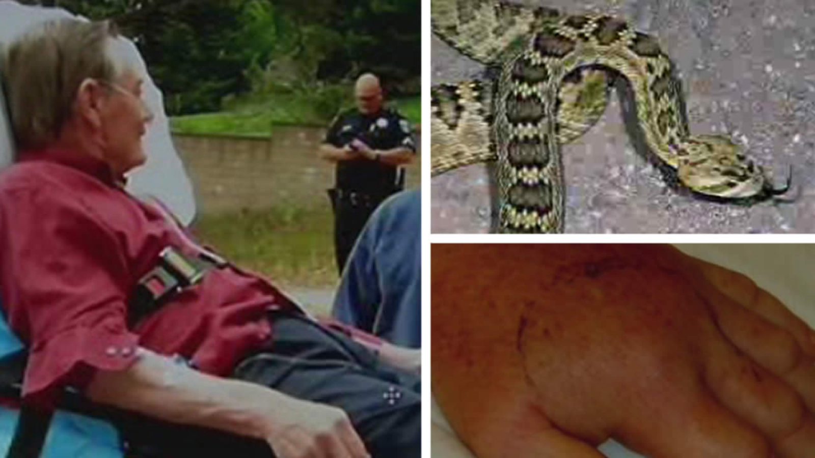 Belmont man suffers rattlesnake bite at his home ABC7 San Francisco