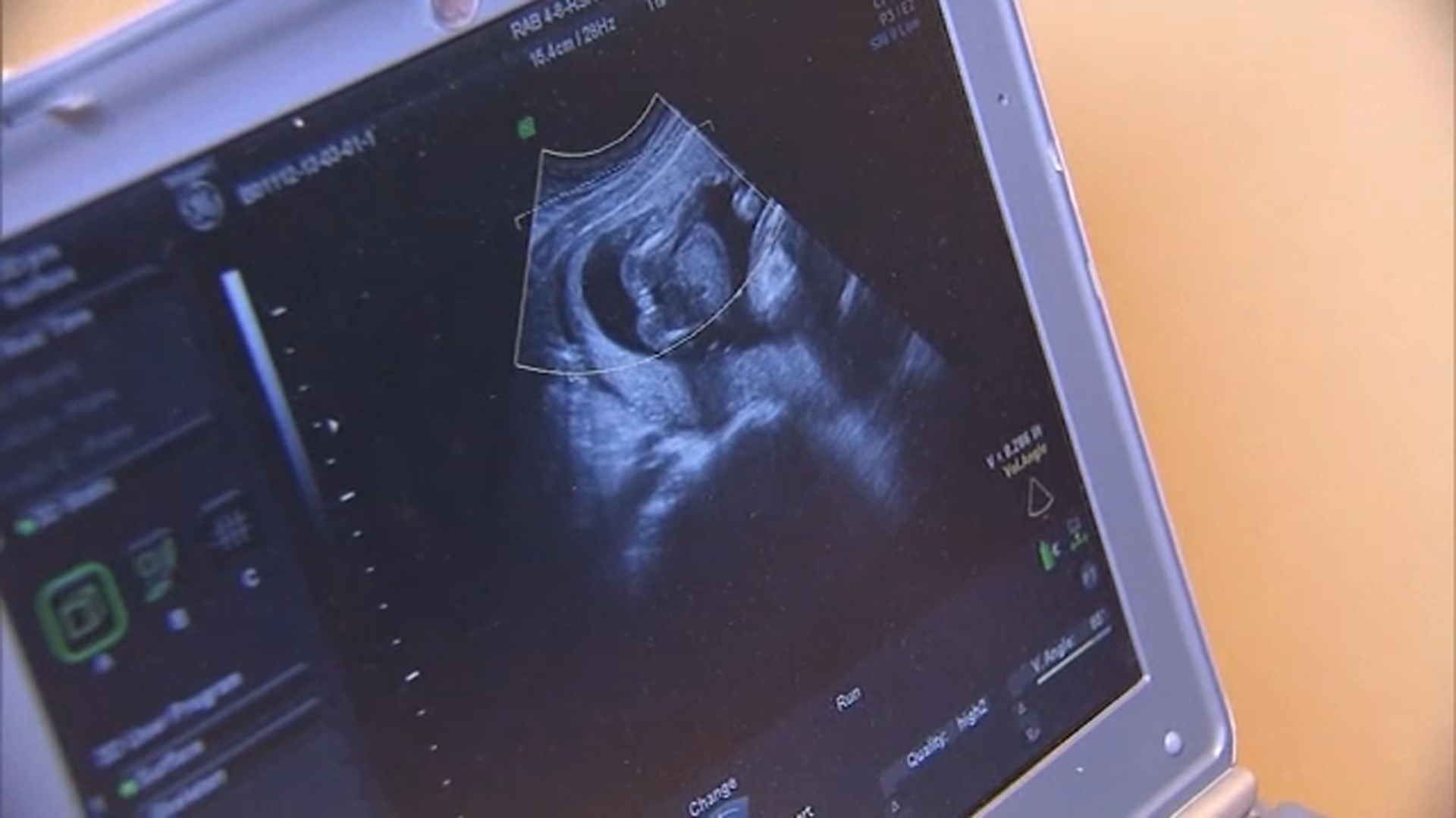 Supreme Court questions Texas law banning most abortions