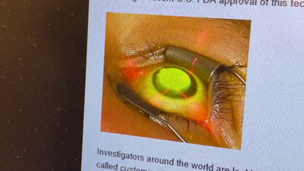 Fresno eye doctor warns about condition impacting more Valley teens