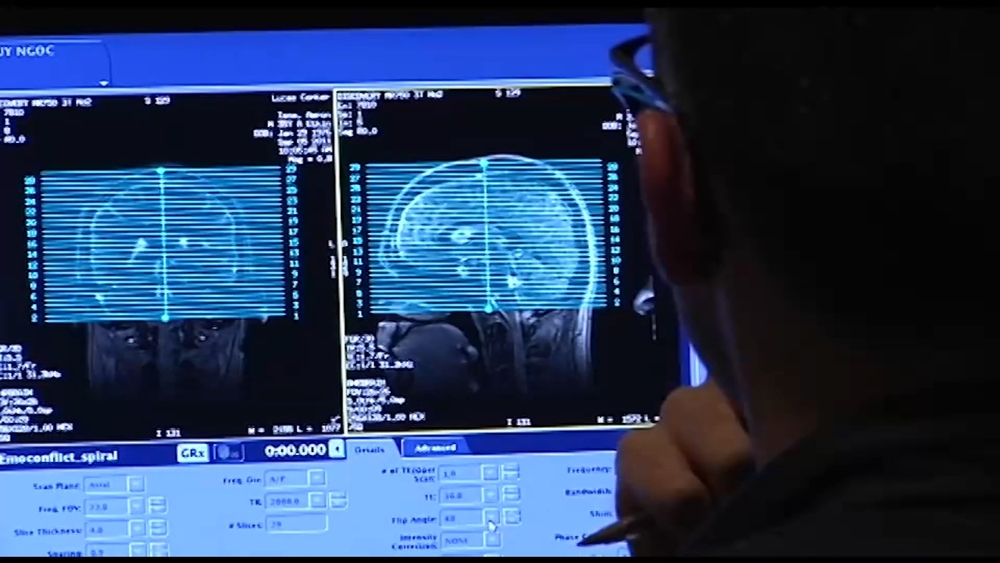 Brain discovery could lead to new traumatic injury treatment