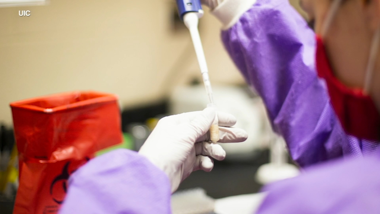 1st case of omicron variant detected in Chicago