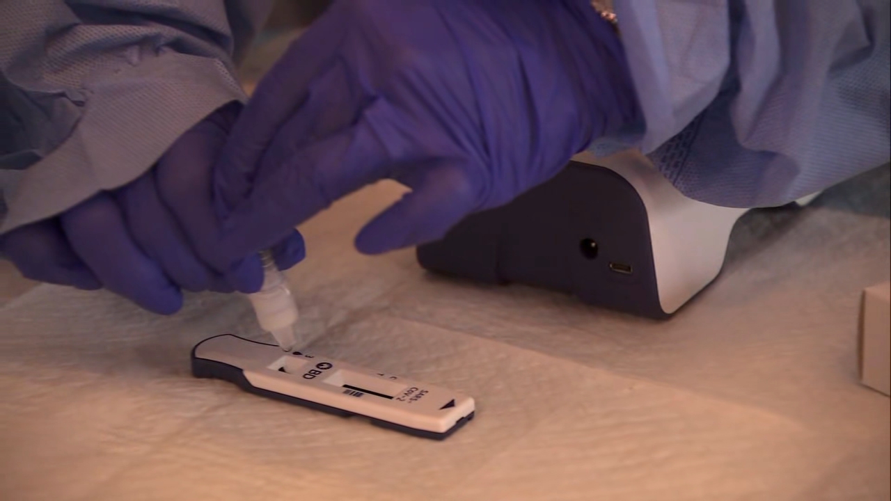 Bay Area company offering at-home COVID test as demand soars