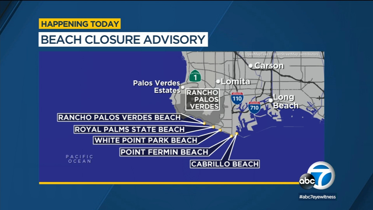 Sewage spill prompts closure of several Southern California beaches
