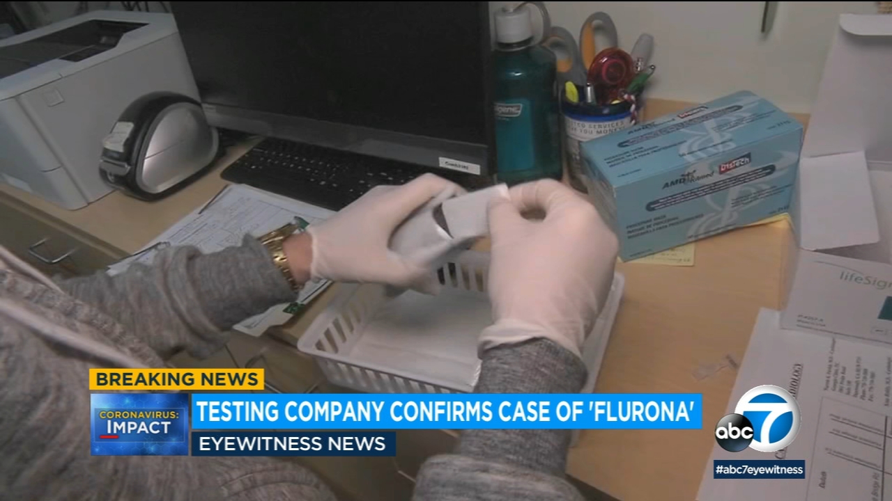 Testing company confirms instance of 'flurona' in SoCal