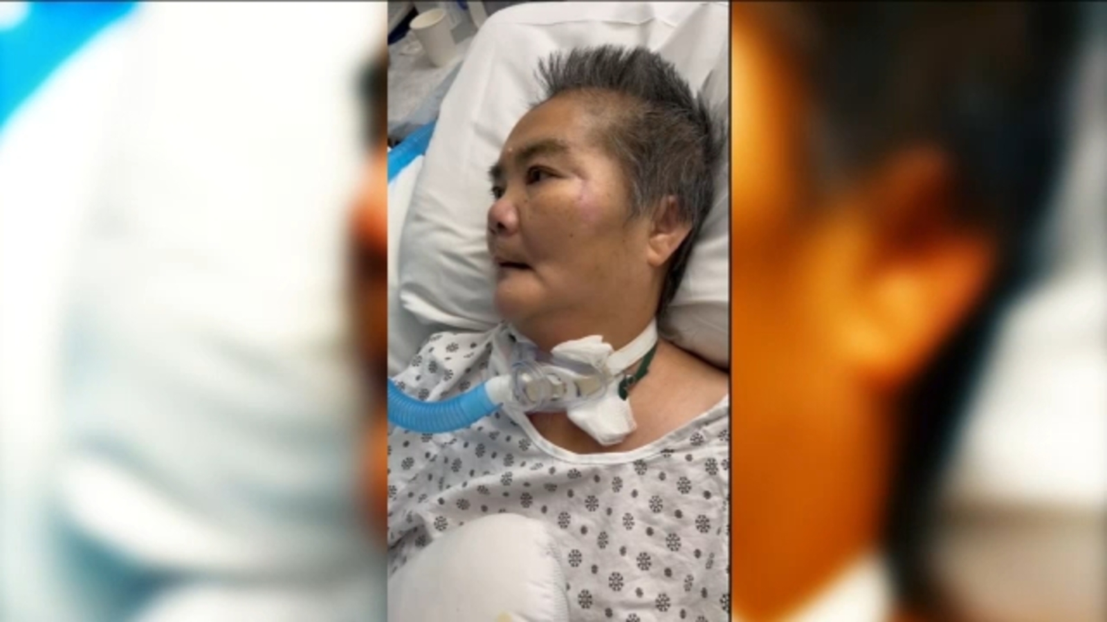 61yearold grandmother dies after being struck in head 61yearold grandmother dies after being struck in head