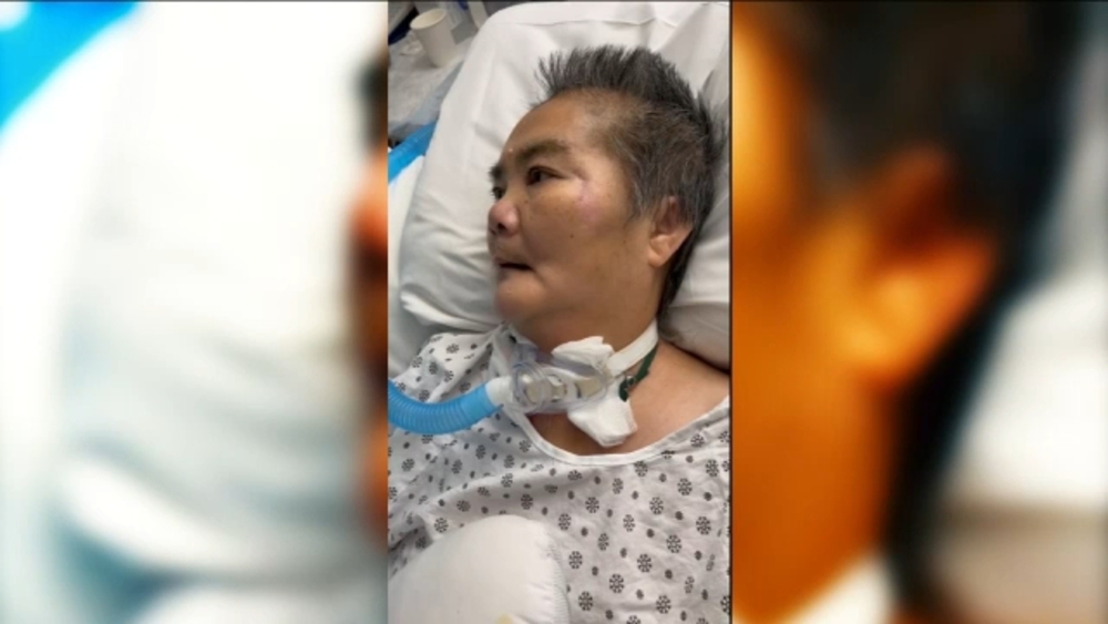 Grandma bashed in head with rock in Queens wakes up from coma