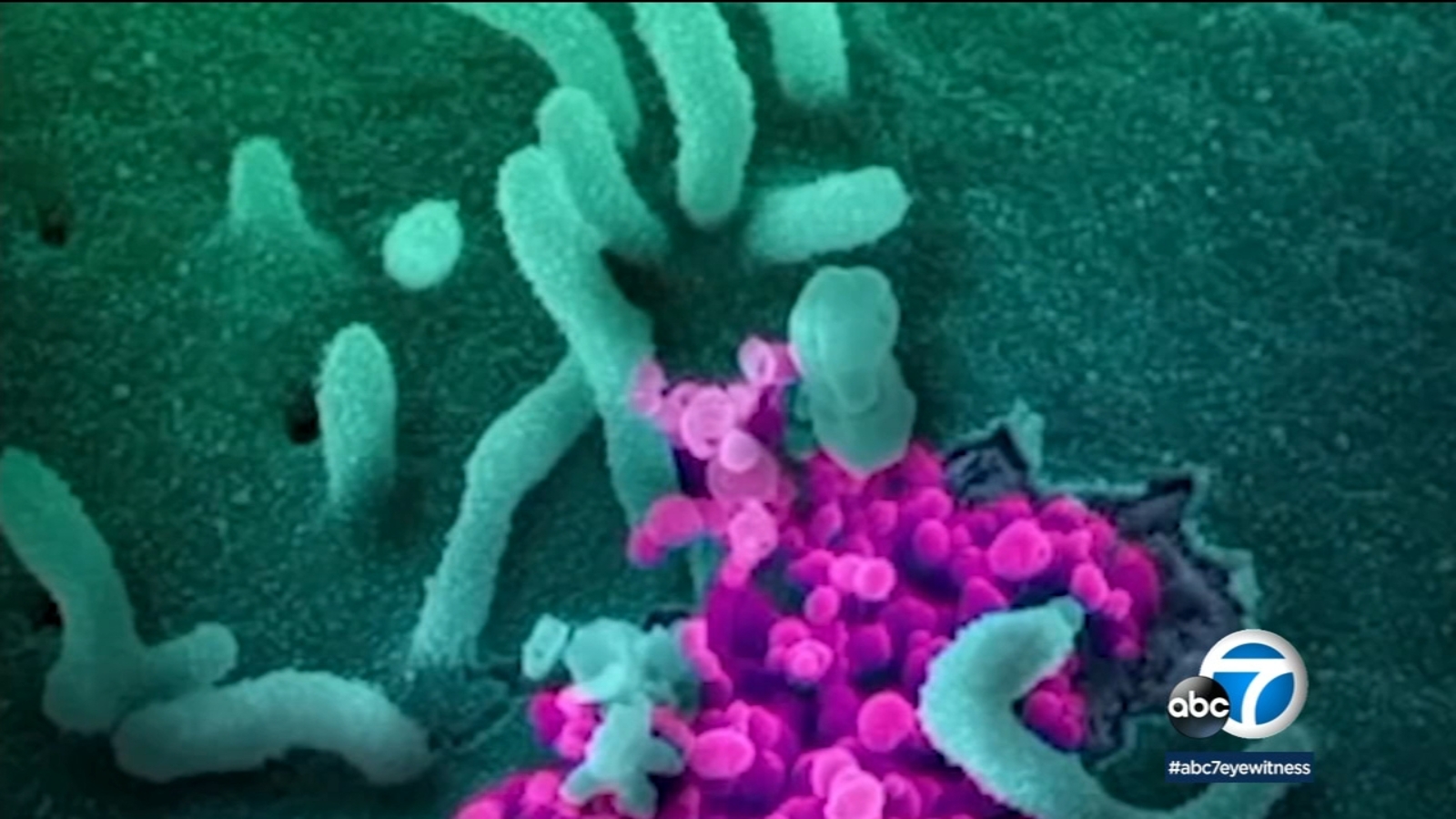 COVIDrelated dizziness A sign of a much deeper health issue ABC7