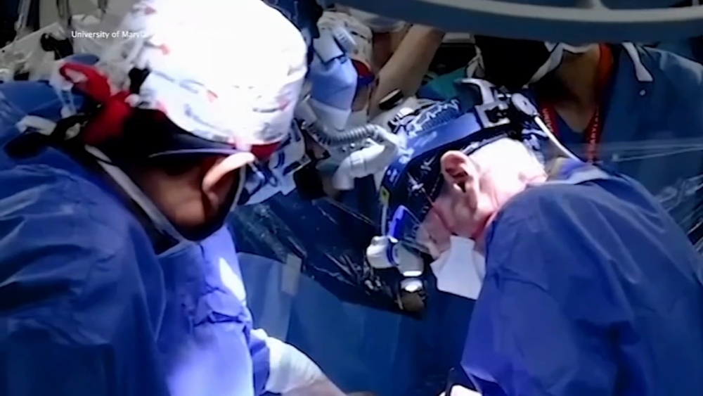 US man who got 1st pig heart transplant dies after 2 months