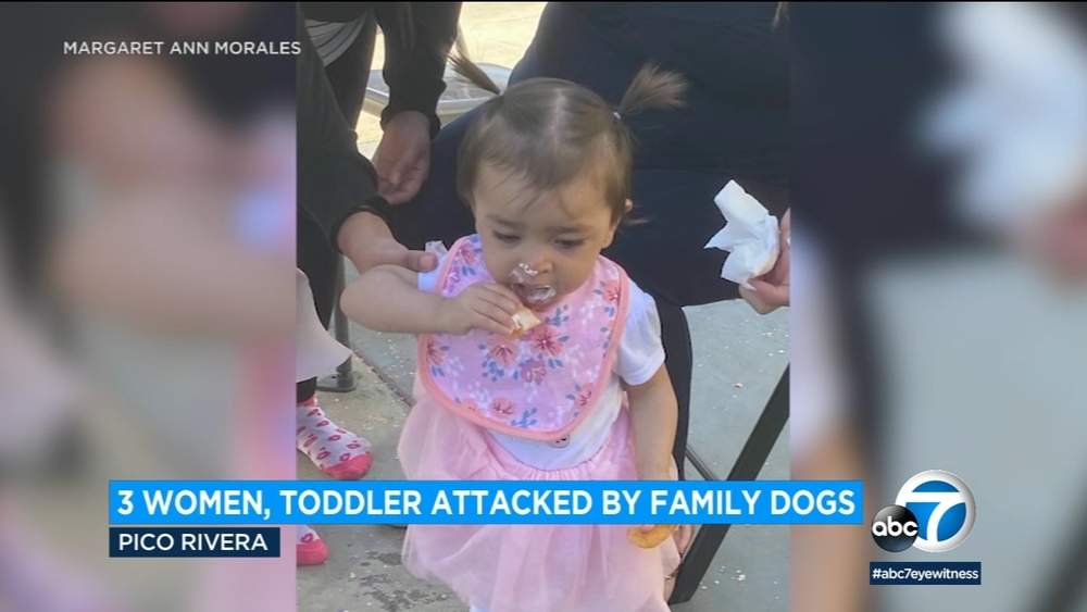 3 women, toddler attacked by family dogs in Pico Rivera