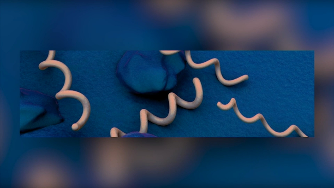 Fresno County struggles to lower newborn syphilis rate