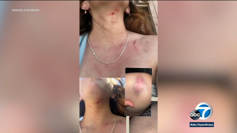 Long Beach teen attacked, injured by stranger after leaving school