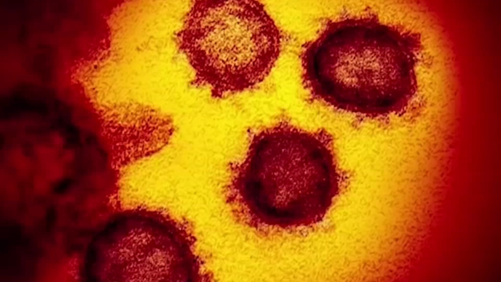 BA 2.12 COVID-19 variant: Doctors warn of new sub omicron variant wave – KTRK-TV