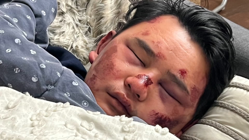 EXCLUSIVE: Nepali man assaulted, robbed in Oakland speaks out