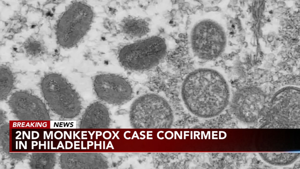 Health officials confirm 2nd case of monkeypox in Philadelphia