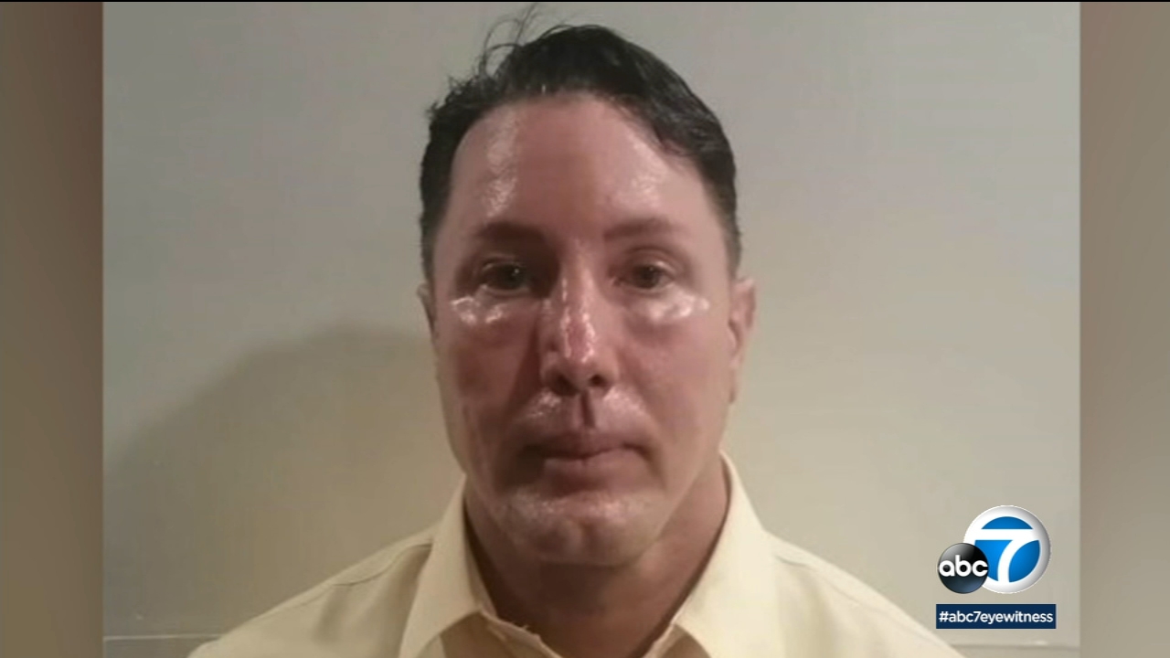 FBI searching for fugitive after woman's remains found in Tijuana