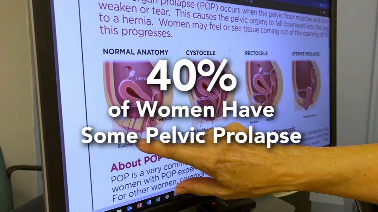 Help for pelvic organ prolapse, a common but underdiscussed condition