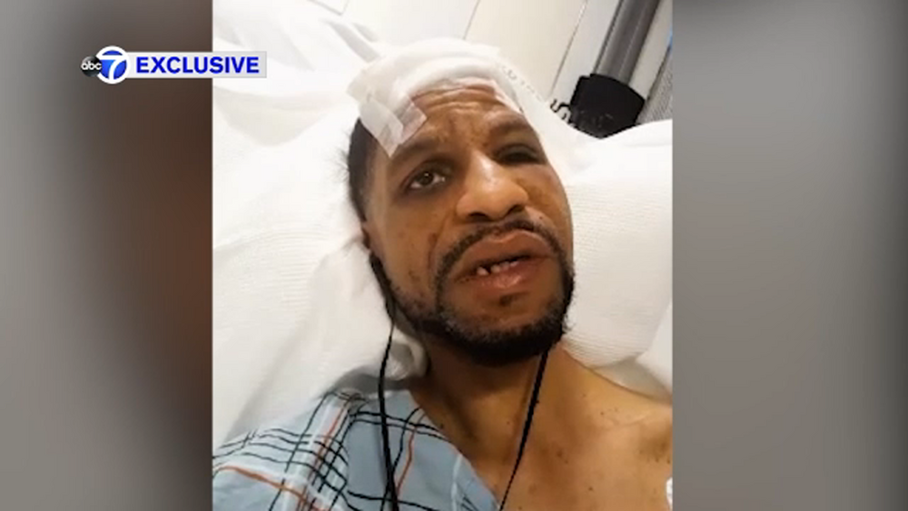 Man says he was assaulted trying to help woman being attacked