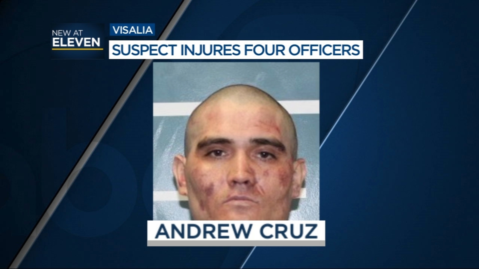 4 Visalia officers injured while trying to arrest domestic violence ...