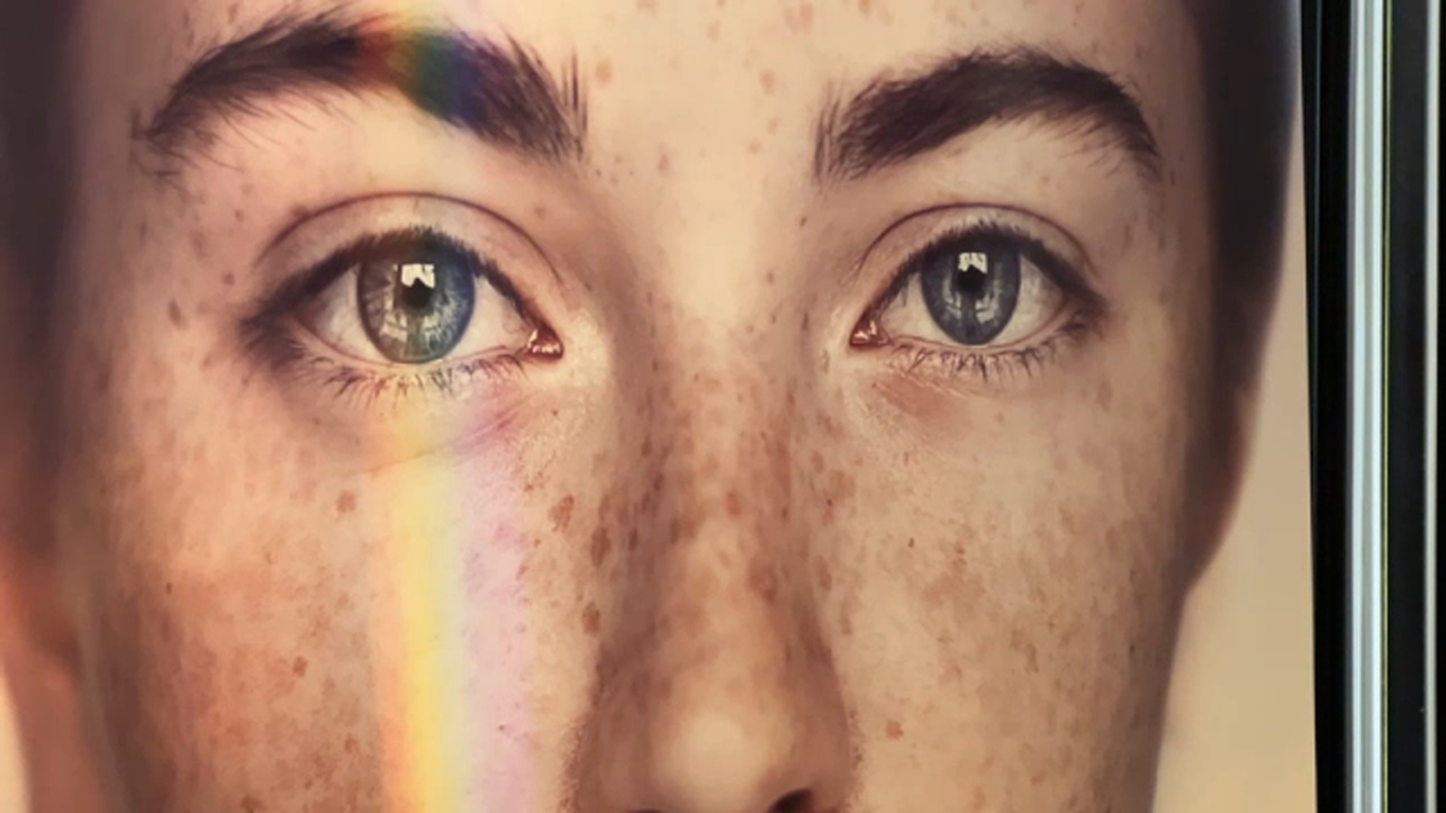 Fresno eye doctor offers new light treatment for dry eye disease ABC30 Fresno